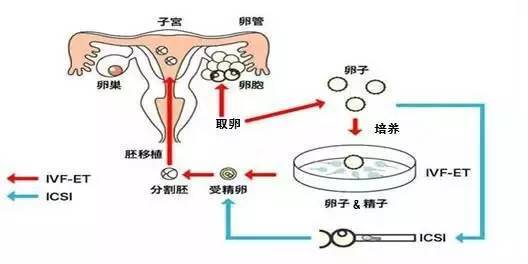 女人容易生男孩的面相