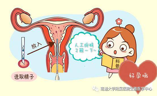 终止妊娠