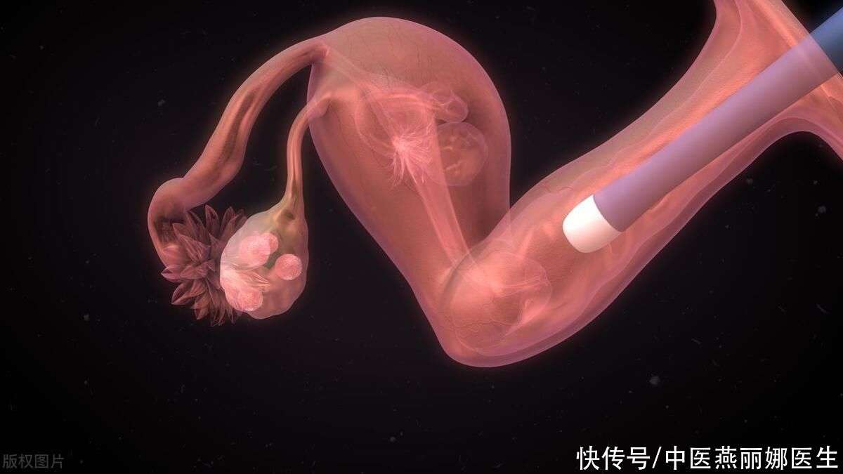 女性不孕不育