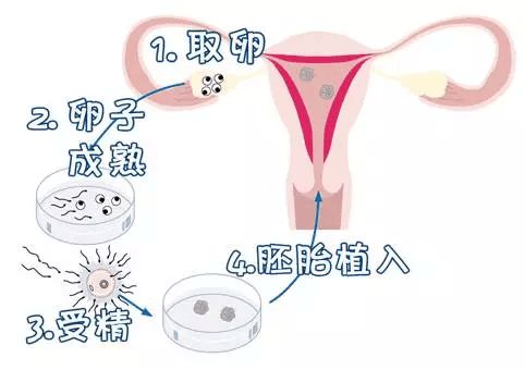 得囊综合征