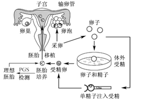 不孕不育