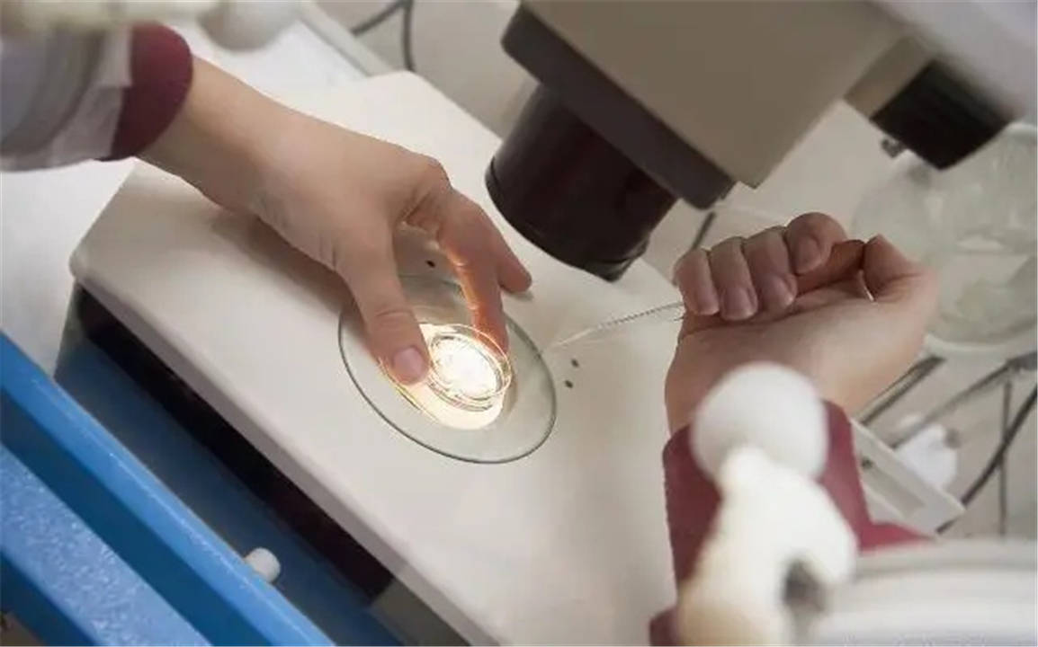 女性卵巢囊肿