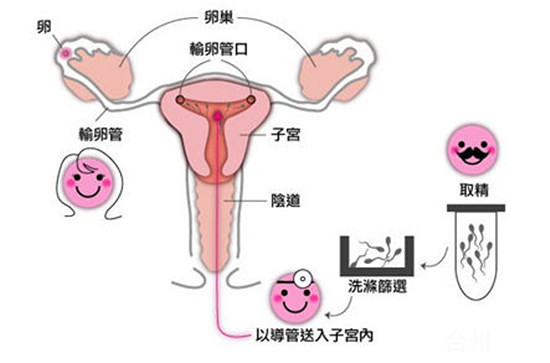 咖啡